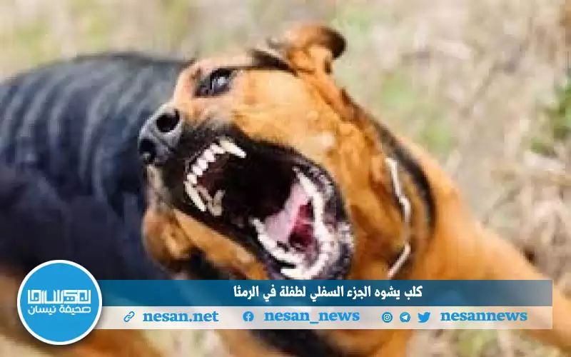 كلب يشوه الجزء السفلي لطفلة في