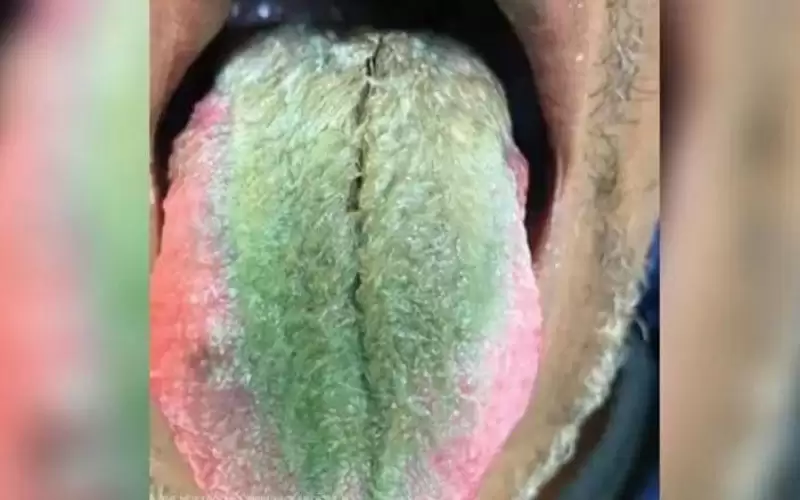 شعر ينبت على لسان رجل أمريكي..