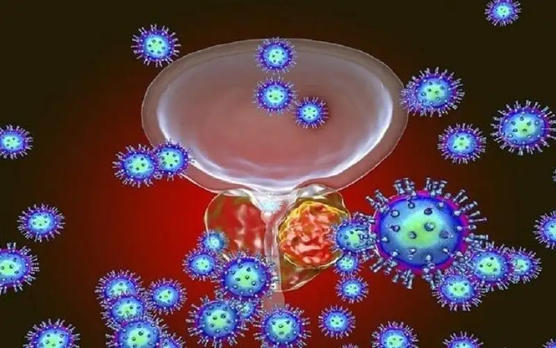 أخصائي أورام يكشف الأعراض الأولى لسرطان