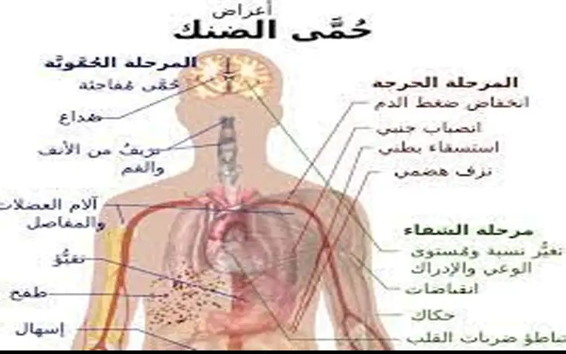 “حمى كسر العظام،” 400 مليون إصابة