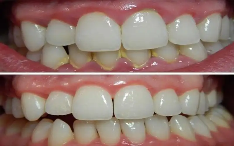 نصائح تهمك.. التخلص من الجير على