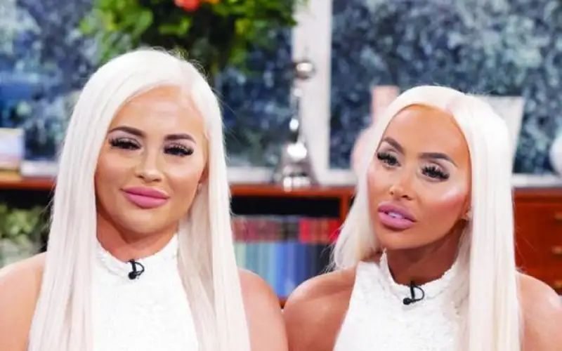 توأمان تنفقان 200 ألف دولار لتصبحا