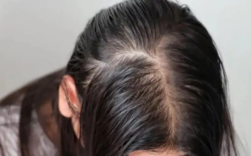 أفضل الزيوت لملء فراغات الشعر