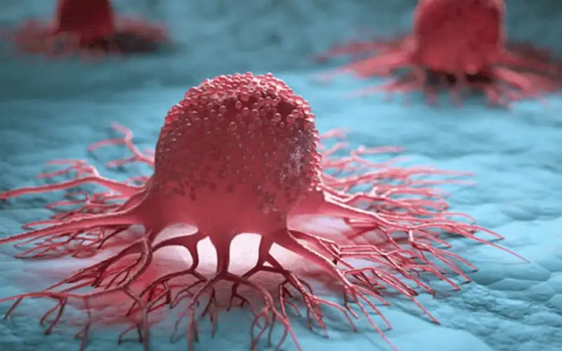 عادات غذائية خاطئة تحفز الإصابة بالسرطان