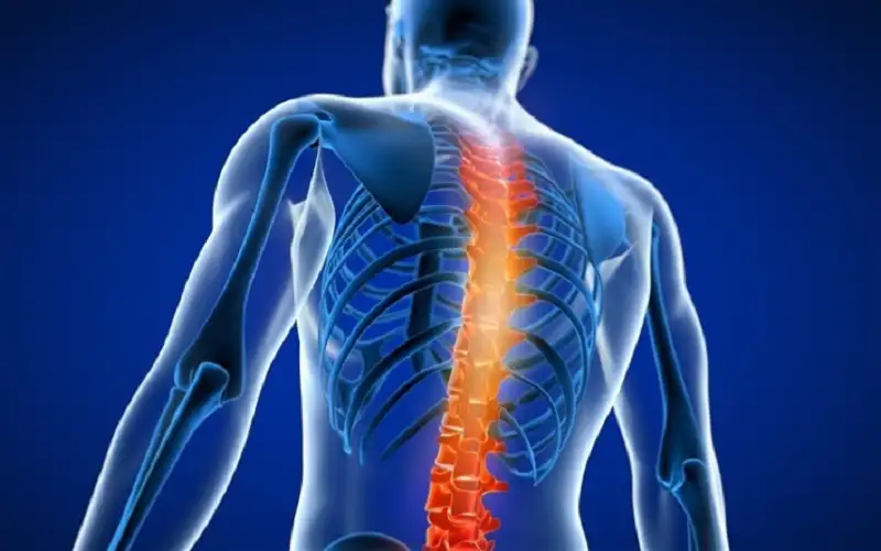 كيف تتعامل مع آلام فقرات الظهر؟