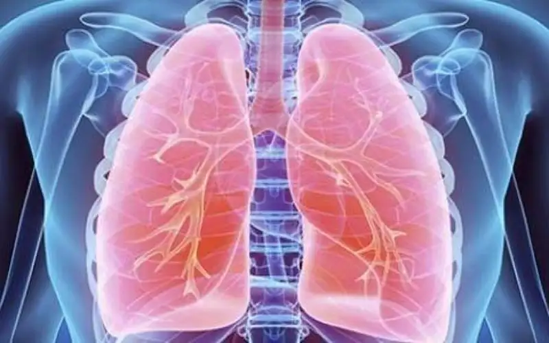 ثبوت إصابة 4 عمال بالتهاب الجهاز