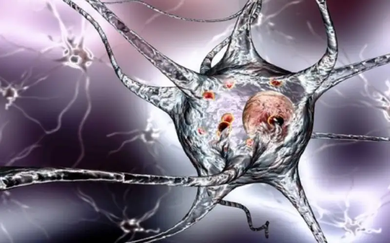 اكتشاف هام يحمي من ألزهايمر وباركنسون