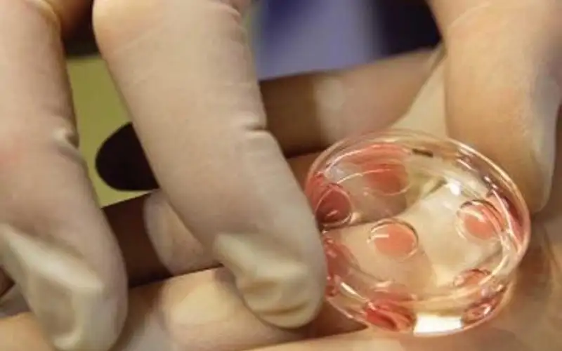 أشيع 6 خرافات عن تجميد البويضات