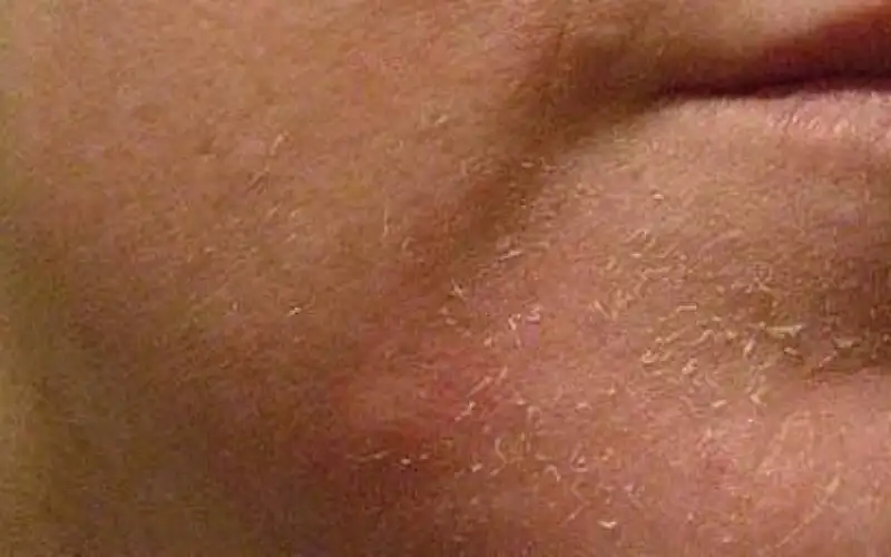 خطوات بسيطة لتنظيف البشرة في المنزل