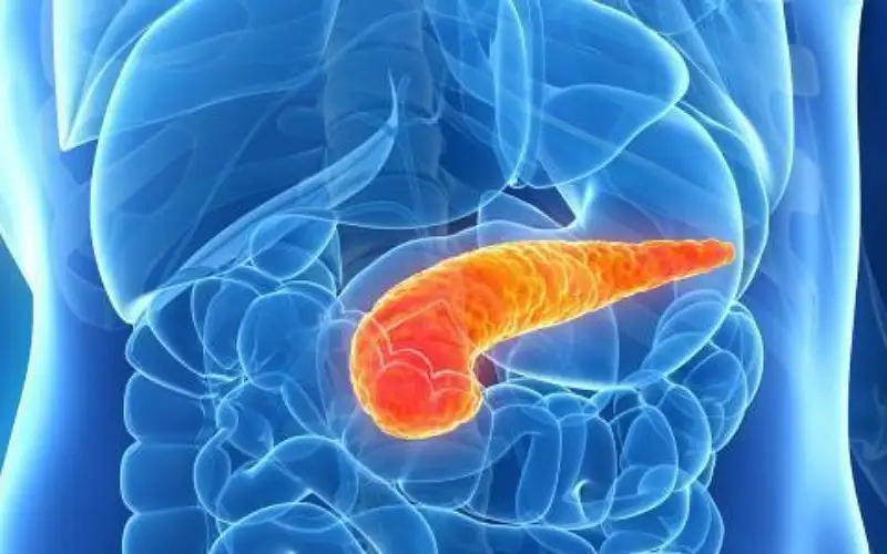 التهاب البنكرياس المزمن.. الأسباب والأعراض والعلاج