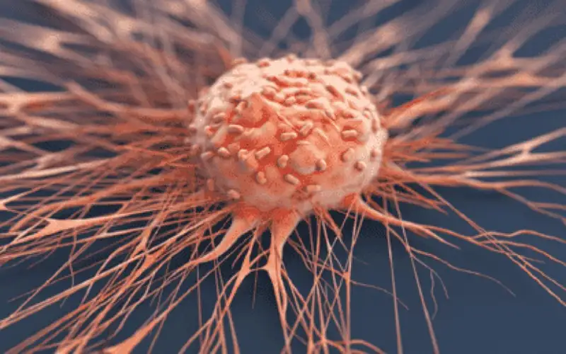 علامات تنذر بسرطان يصيب الرجال