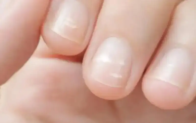 نصائح مهمة لإزالة الخطوط البيضاء عن