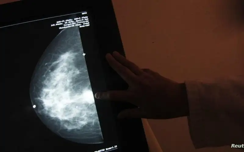 دراسة تحذر من إهمال الفحص المبكر