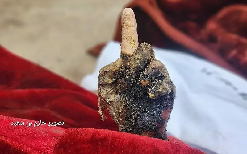 الدفاع المدني بغزة: الاحتلال يستخدم قنابل