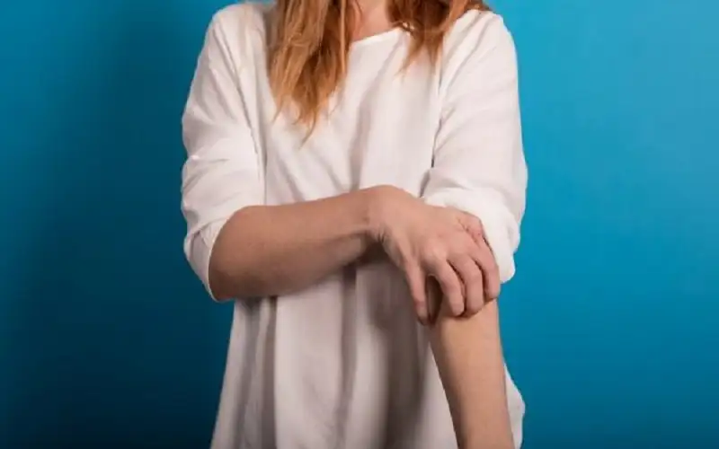 أنواع وطرق علاج الصدفية