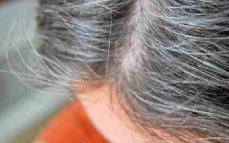 أطعمة صادمة تقيكم من الشـيب المبكر