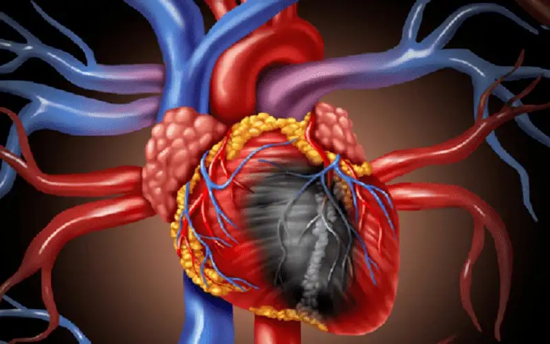 الكشف عن عامل مهمل يزيد من