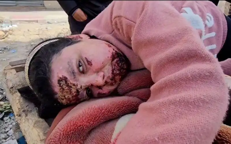 الصحة العالمية: تدمير مستشفى كمال عدوان