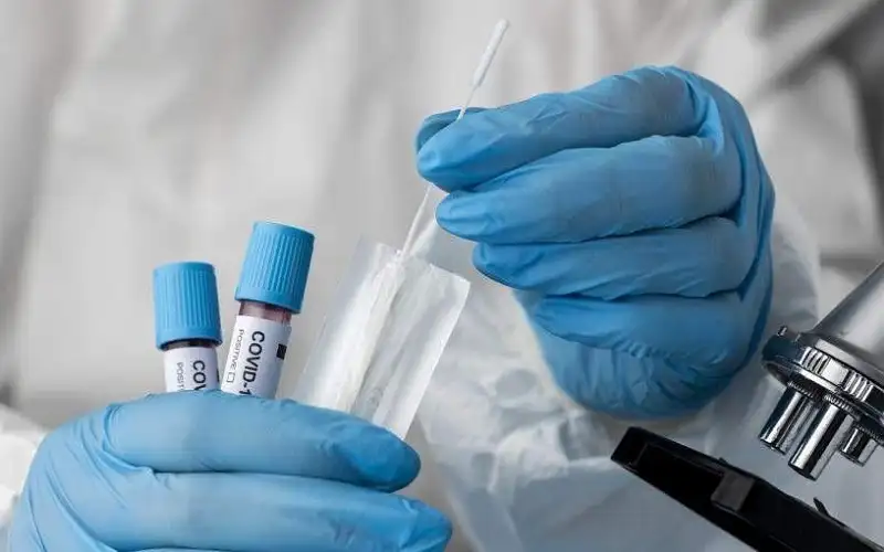 مليون إصابة بفيروس كوفيد عالميا خلال