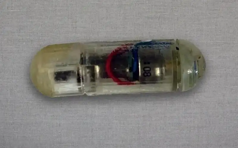 كبسولة إلكترونية للبلع.. لكبح الشهية