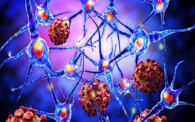 80% من مرضى المناعة الذاتية هن