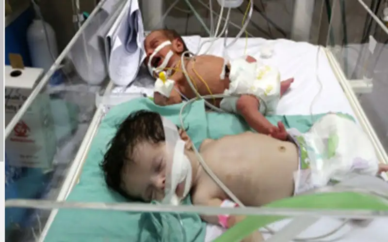 مدير مستشفى العودة: لا نستطيع توفير