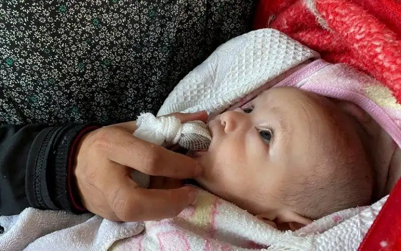 الجوع يلتهم 13 طفلا في كمال