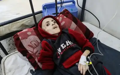 صحة غزة: رصدنا نحو مليون إصابة