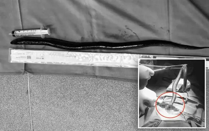 عانى من آلام مبرحة .. فوجد