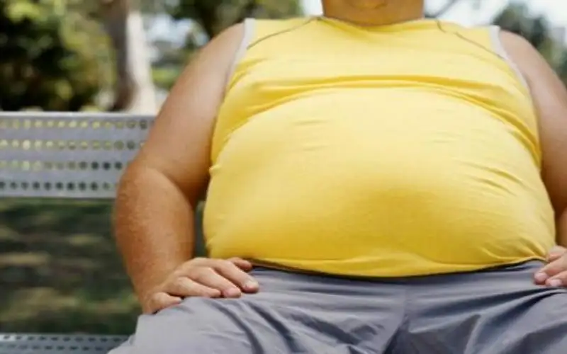 70% من الاردنيين مصابون بالسمنة