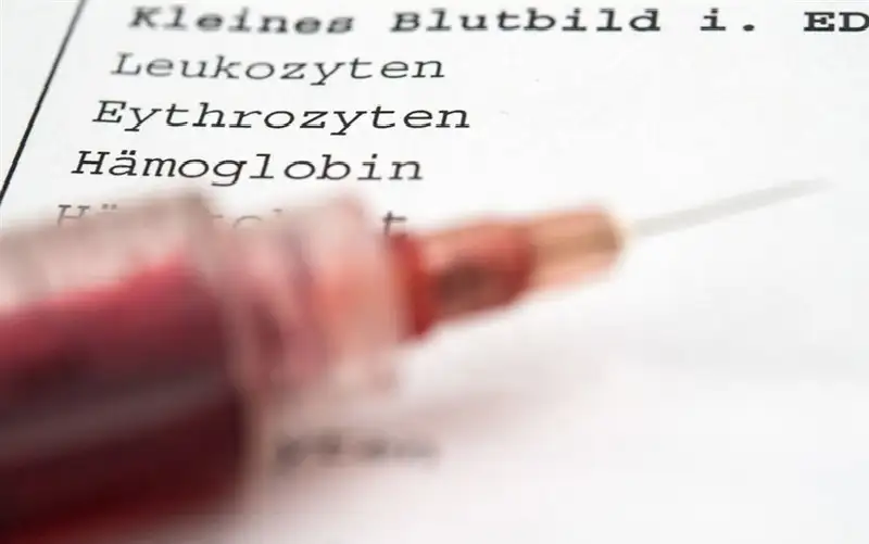 البقع الزرقاء على الجلد تدق ناقوس