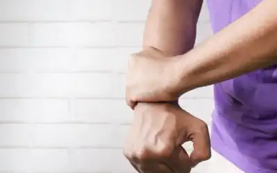 أسباب ظهور البقع الزرقاء على الجلد