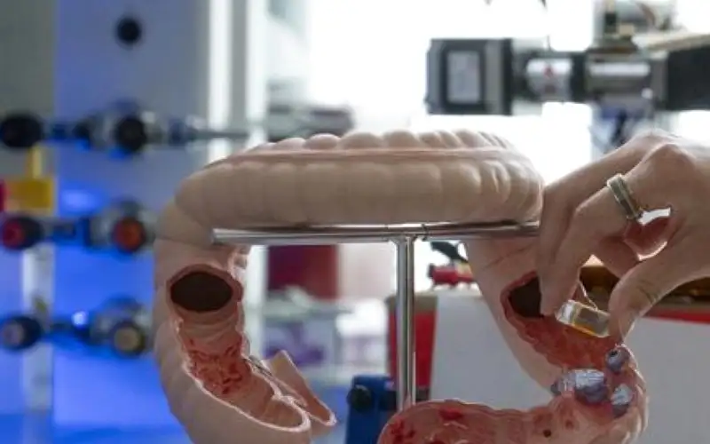 حبوب ذكية تراقب الجهاز الهضمي