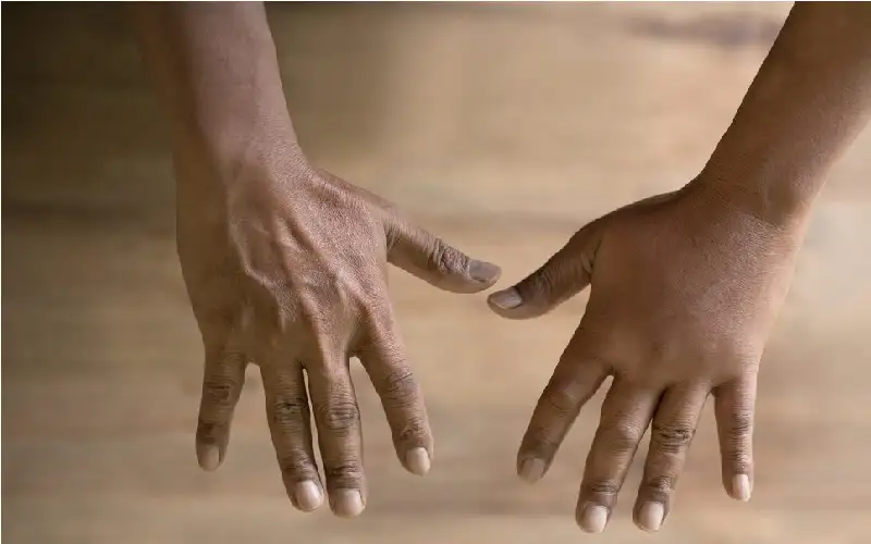 8 أسباب تؤدي إلى تورم اليدين