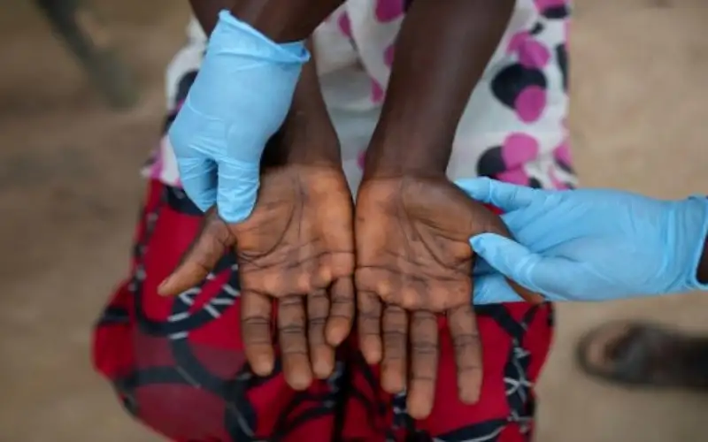 الصحة العالمية وعلماء يدعون لتحرك عاجل