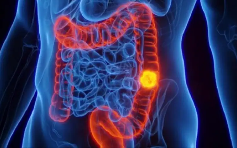 ومن الخس ما قتل .. بريطانيا