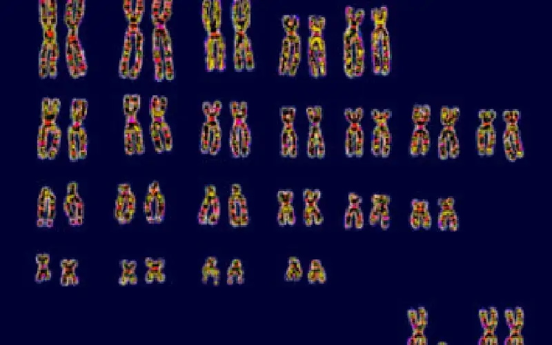 الكوابيس.. قد تنبه من هذه الأمراض