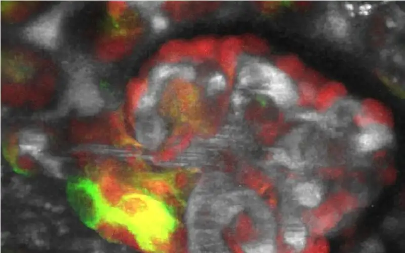 فقدان الملح يحفز تجديد الكلى