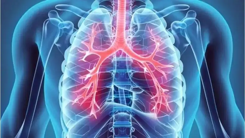 علاجات متطورة لسرطان الرئة تعطي الأمل