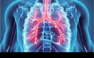 علاجات متطورة لسرطان الرئة تعطي الأمل