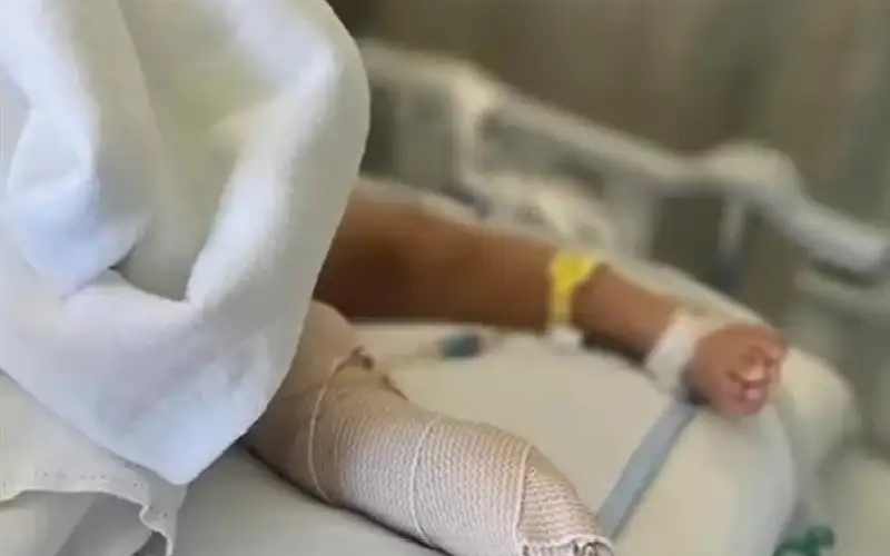 جزازة عشب تبتر رجل طفل في