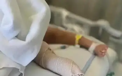 جزازة عشب تبتر رجل طفل في