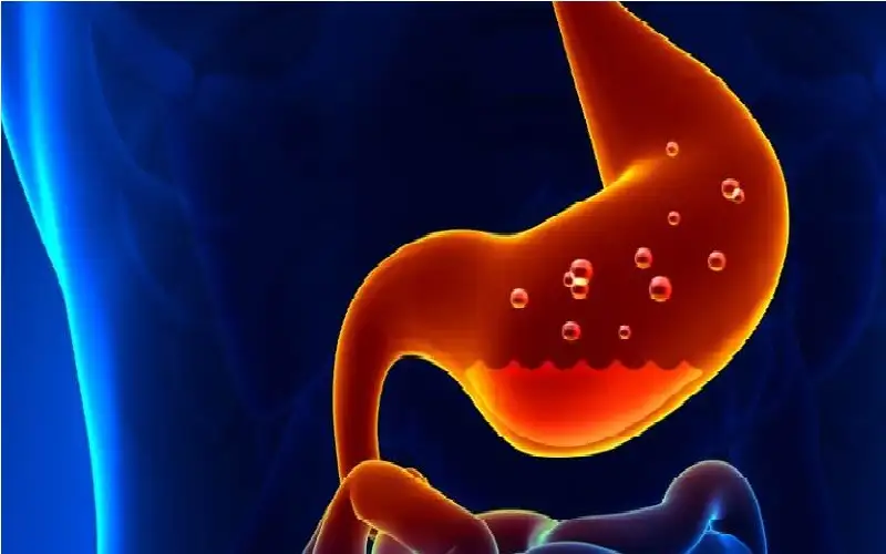 احذر حرقة المعدة المستمرة.. مؤشر للإصابة