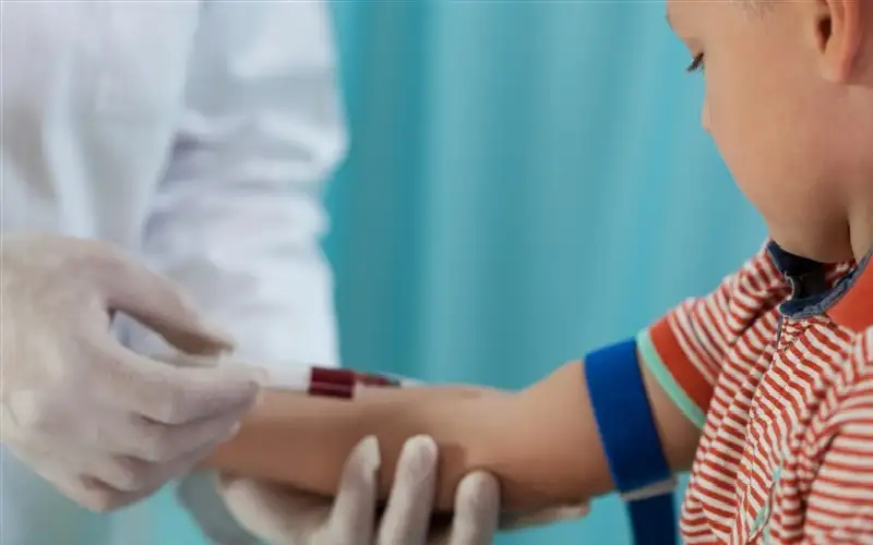 كيف يمكن العناية بالطفل المصاب بالكوليسترول