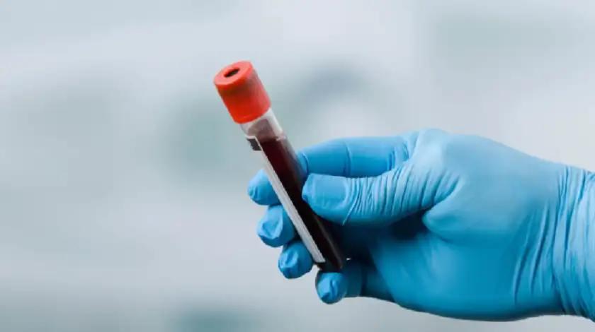 تسجيل عقار جديد لعلاج سرطان البروستاتا