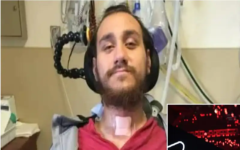 شركة نيورالينك التابعة لإيلون ماسك تطور