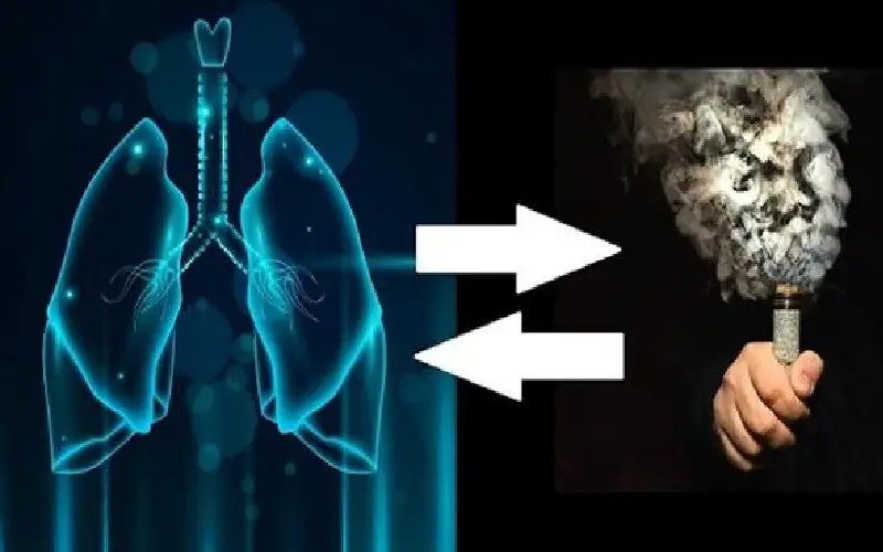 السجائر الإلكترونية تتسبب بثقب في الرئة