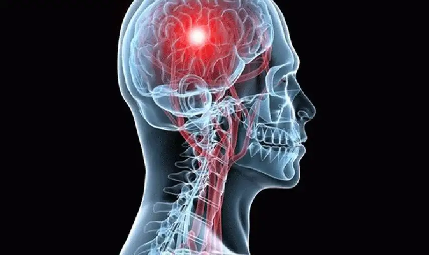 النشاط اليومي العادي لا يكفي للوقاية