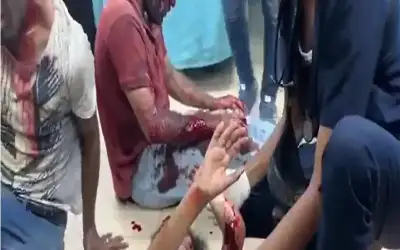 مشاهد مروعة.. اللحظات الأولى لمجزرة الاحتلال
