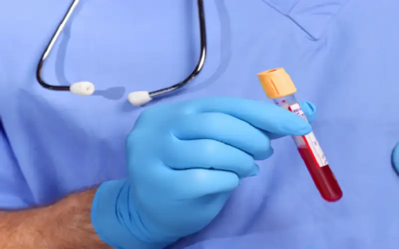 إنجاز طال انتظاره في تشخيص ألزهايمر